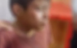 Un nene de 8 años terminó internado con quemaduras tras explotarle un petardo en la cara