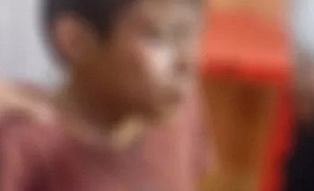 Un nene de 8 años terminó internado con quemaduras tras explotarle un petardo en la cara