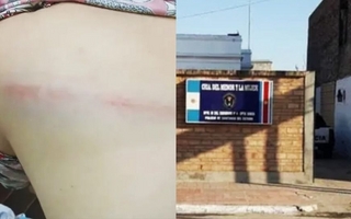 Un hombre golpeó con un látigo a su esposa por cebar feo el mate