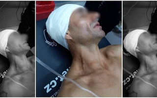 Violencia extrema: un hombre terminó golpeado en la cabeza y herido con un machete 