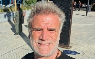 Teto Medina: tiene cáncer de colon y sufre por el duro tratamiento