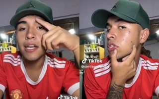 Violento robo en Chimbas: golpearon a un influencer para robarle el celular 