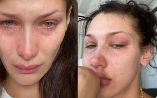 Sadfishing, la tendencia de exponer el dolor en redes para dar lástima 