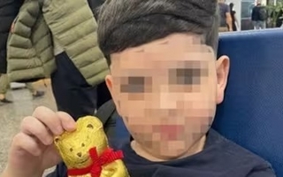 Evolución de Bastián: fracturas de cráneo y monitoreo permanente