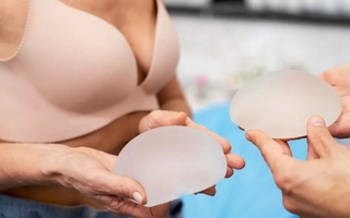 Diez consejos clave antes de una cirugía mamaria estética