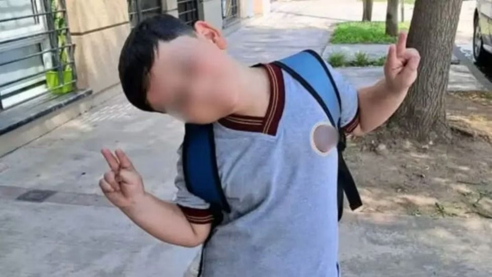 Nene de 8 años internado grave tras choque en Pinamar: le harán una traqueotomía