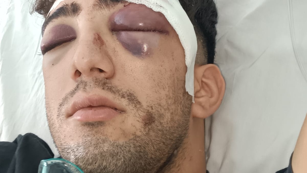 Viajaba en Uber, sufrió un accidente y necesita más de $6 millones para operarse