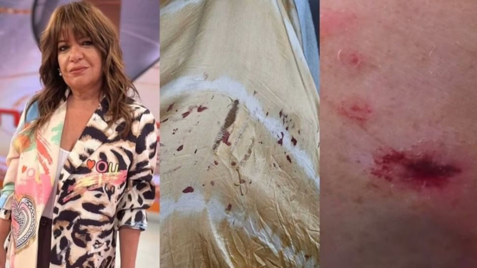 Andrea Taboada contó que un perro la mordió y se peleó con los dueños