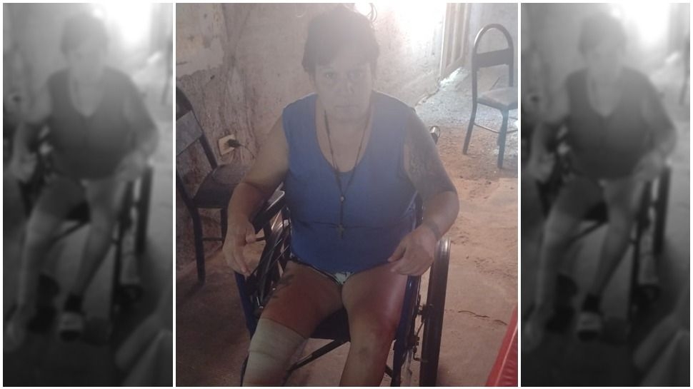 Iba en moto y se cayó por esquivar un perro: se quebró y no podrá trabajar por 8 meses