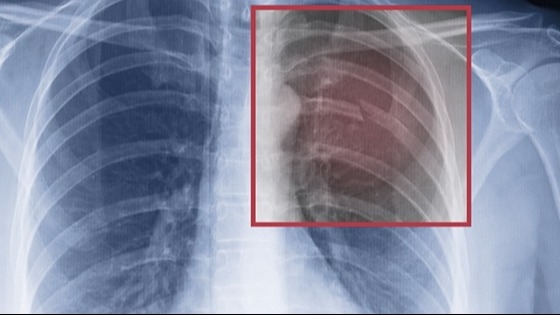 El mal momento de un famoso: “Me fracturé la cabeza, tres costillas y la clavícula”