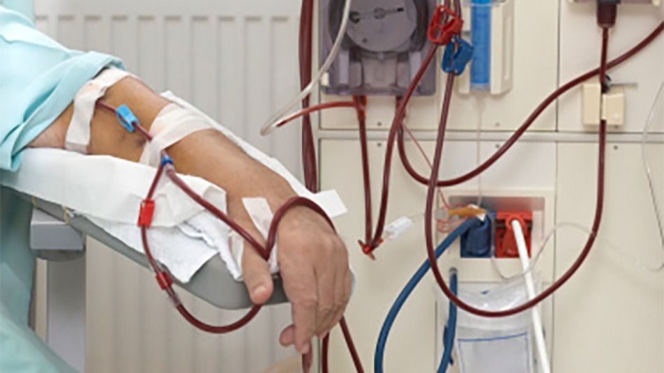 Se realizó la primera diálisis en el Hospital San Roque de Jáchal
