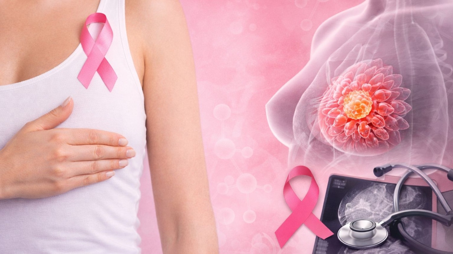 Cáncer de mama: por qué detectarlo a tiempo hace la diferencia