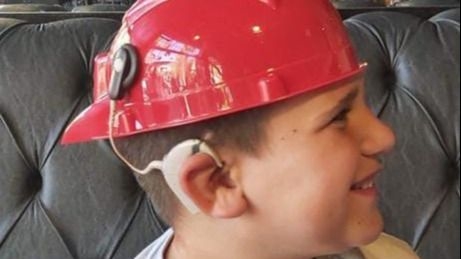 Histórico: realizaron cirugías de implante coclear en el Hospital de Angaco