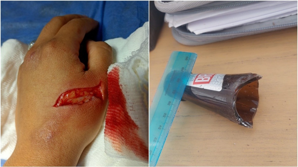 Gresca en el barrio General Acha dejó a una policía con una herida cortante