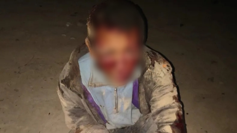 Lo descubrieron robando en una casa de Chimbas y lo lincharon