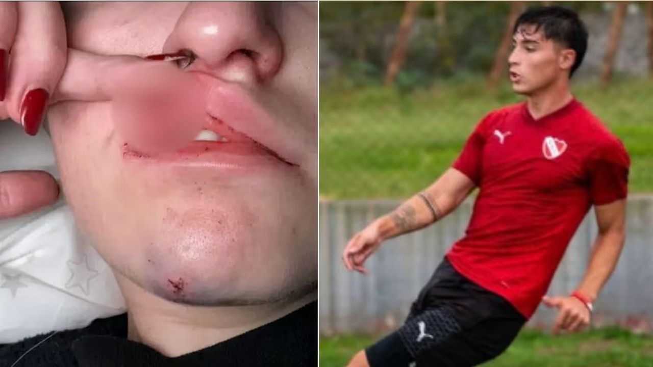 Denuncian a un jugador de Independiente por haber golpeado a su ex