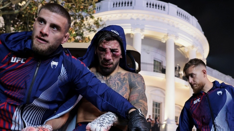 Así quedó el rostro de Ilia Topuria, figura de la UFC: “No veo casi nada”