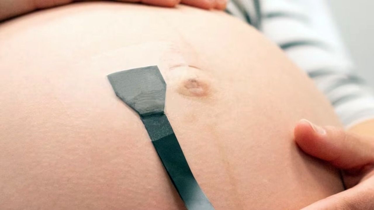 Crean un parche para monitorear a bebés en embarazos riesgosos las 24 horas
