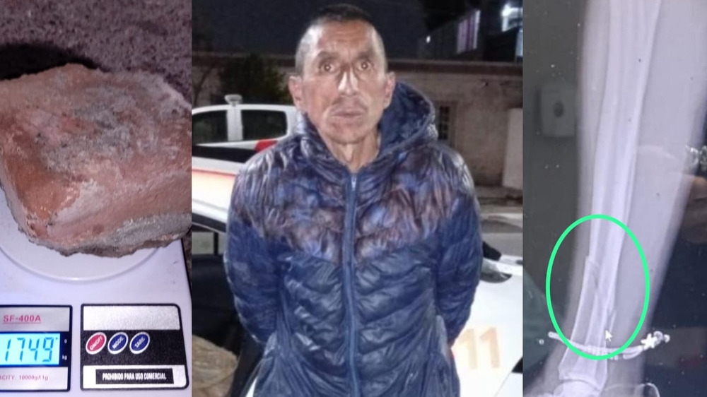 Tres años de prisión para el hombre que atacó a su pareja con un ladrillo y la fracturó
