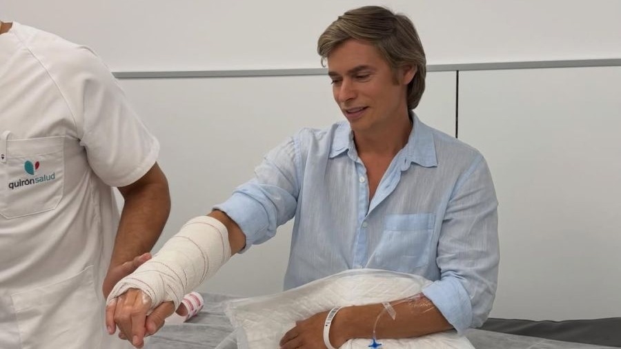 Carlos Baute se fracturó la muñeca tras sufrir un accidente de surf