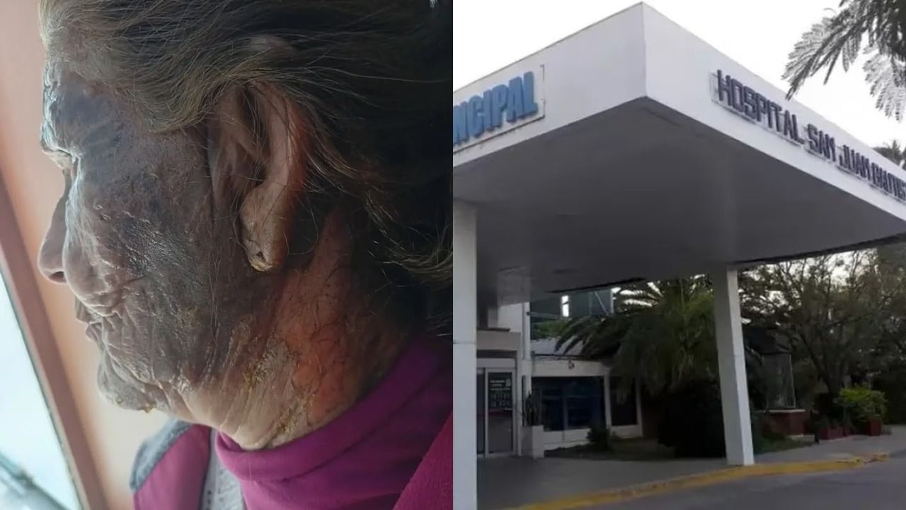Un hombre roció con gasoil a su vecina de 84 años y la prendió fuego