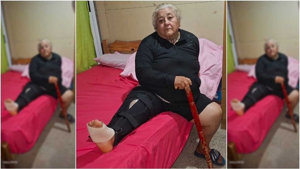 Una mujer espera una prótesis para caminar y reclama que PAMI no da respuesta