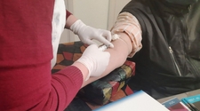 Hepatitis en San Juan: hay alrededor de 35 pacientes trasplantados por la enfermedad