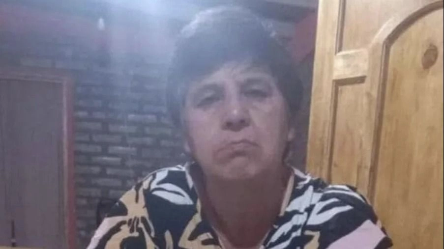 Ella es la mujer que se quemó el 70% del cuerpo tras un accidente en Angaco