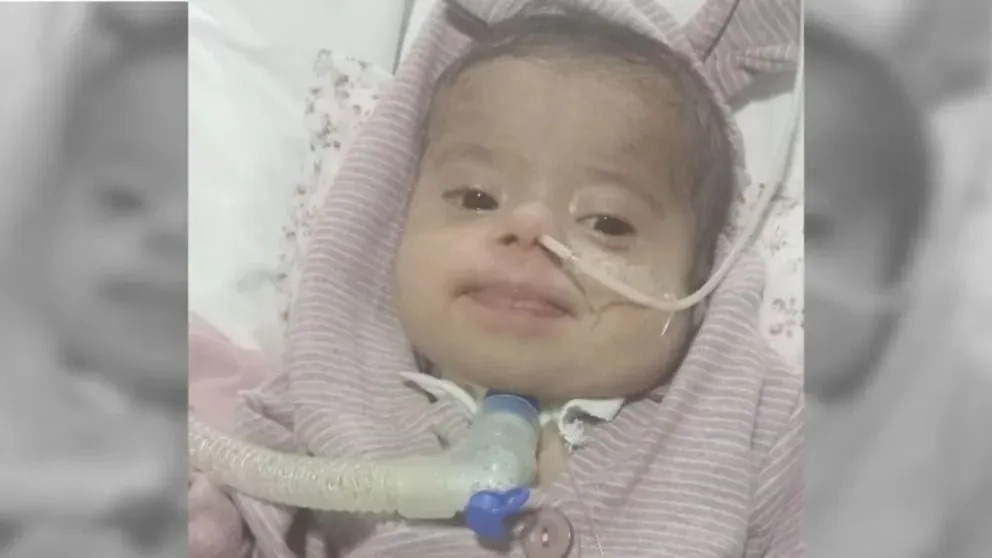 Murió Emilia, la bebé sanjuanina que esperaba una cirugía cardíaca
