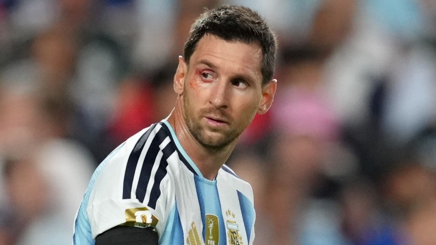 Qué le pasó a Messi debajo del ojo durante el partido ante Suiza