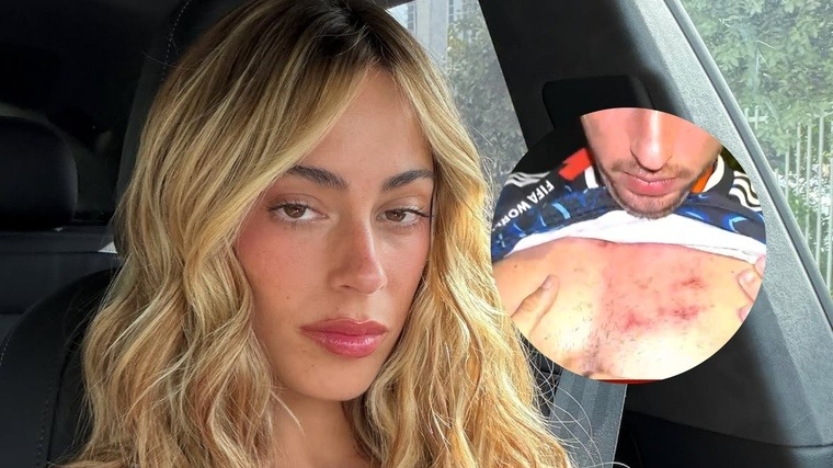 Un periodista contó que fue agredido por la seguridad de Tini Stoessel