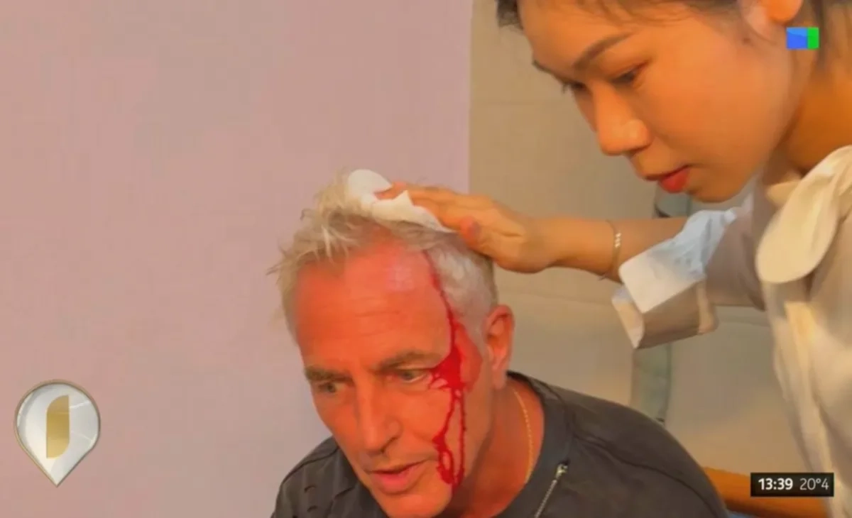Marley sufrió un accidente en Tailandia durante la grabación de "Por el mundo"