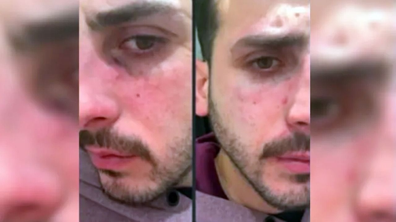 “¿Te pegó otra vez?”: los chats y fotos que exponen la violencia que sufría el joven asesinado