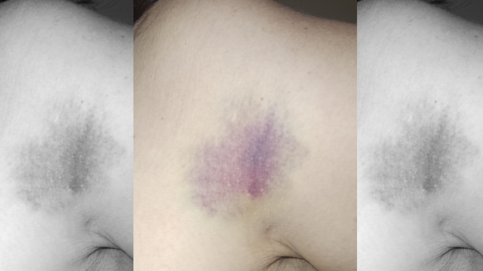 Dirigente de Rawson Juniors fue golpeada durante una jornada de inferiores