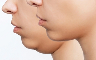 El sencillo ejercicio de 5 minutos que ayuda a fortalecer el cuello y reducir la papada