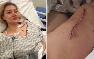 Nadia Beller mostró nuevas fotos de las heridas del ataque: “Que Dios te perdone, Fernando Cerimedo”