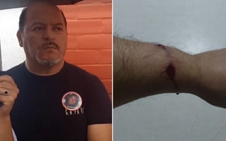 Un referente que acompaña a víctimas de delitos fue baleado y mató a un delincuente