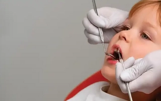 Caries infantiles: causas y prevención clave