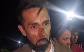 Golpearon a un reconocido comerciante y a su familia en Rawson