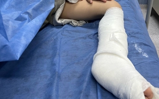 Un hombre atropelló a un niño, lo quebró, agredió a la madre y escapó