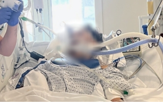 Un adolescente murió en Estados Unidos tras infectarse con una rara ameba