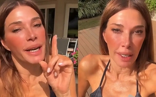 El fuerte problema de salud que hace sufrir día a día a Catherine Fulop
