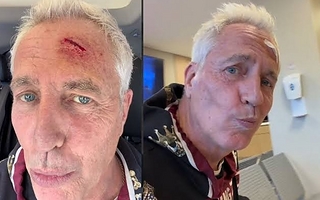 Marley sufrió un accidente en la cabeza y debió ser atendido de urgencia
