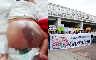 Tras la nota en DIARIO HUARPE, consiguieron la derivación para el bebé con malformación vascular