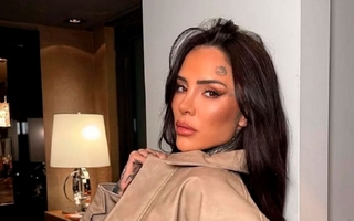 El gravísimo accidente que sufrió Cande Tinelli que asustó a todos