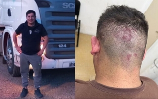  Un trabajador denunció una brutal golpiza ordenada por su jefe