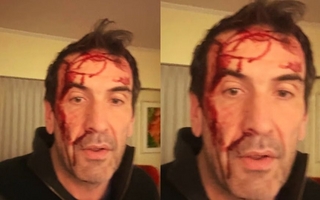 Golpearon a un candidato de La Libertad Avanza: "Zona liberada"