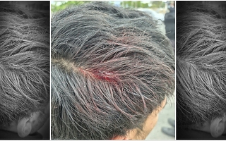 Un hombre terminó con un corte en la cabeza tras una agresión