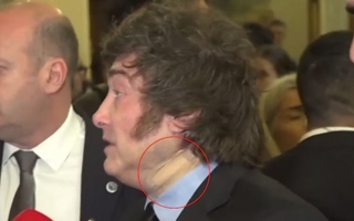 Milei apareció con una venda en el cuello y el Gobierno reveló qué pasó