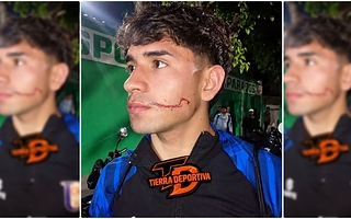 Atacaron a piedrazos el colectivo de Unión y varios jugadores resultaron heridos 